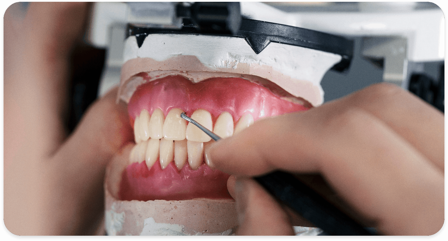 Prosthodontics