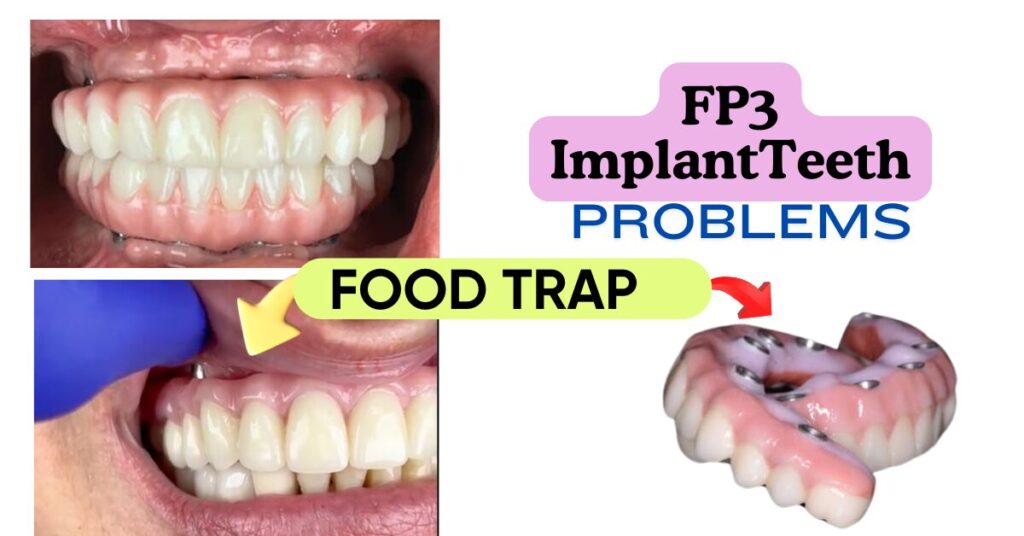 FP3 TEETH - food trap issue