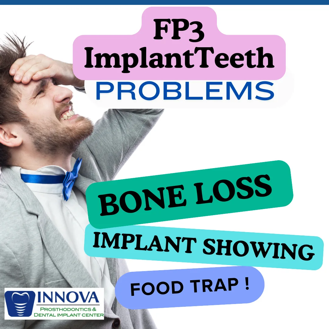 FP3 implant bridge - a lot potentials problems-